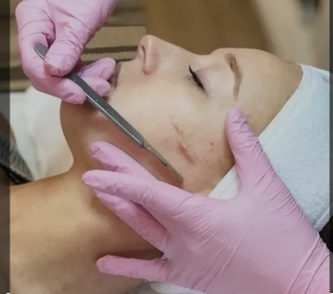 Dermaplaning
